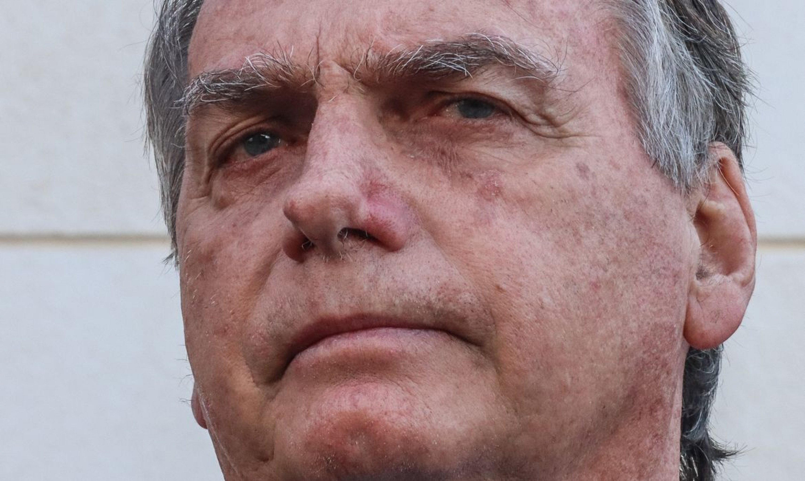 Moraes autoriza Bolsonaro a ser submetido a ultrassom na prisão