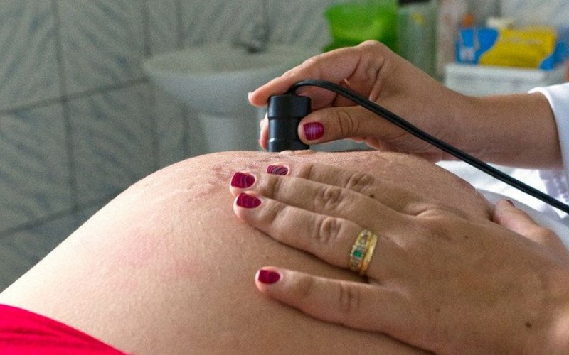 Exame pré-natal reduz chance de bebê nascer com anomalia