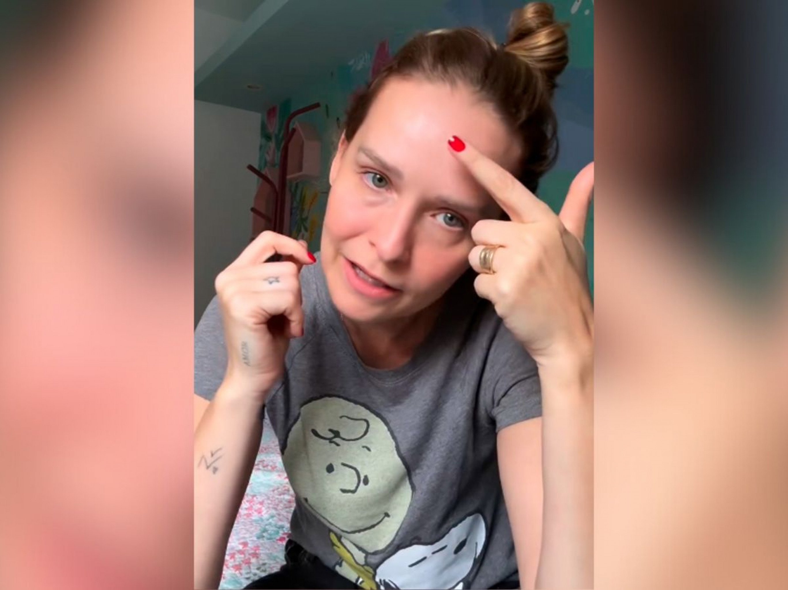 CARCINOMA BASOCELULAR: Atriz Fernanda Rodrigues diz que câncer de pele voltou e faz alerta