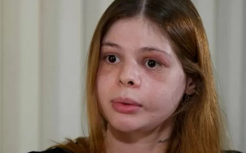 Samira Khouri, de 27 anos, segue em recuperação após ser brutalmente agredida pelo ex-namorado Pedro Camilo Garcia, fisiculturista de 24 anos | abc+