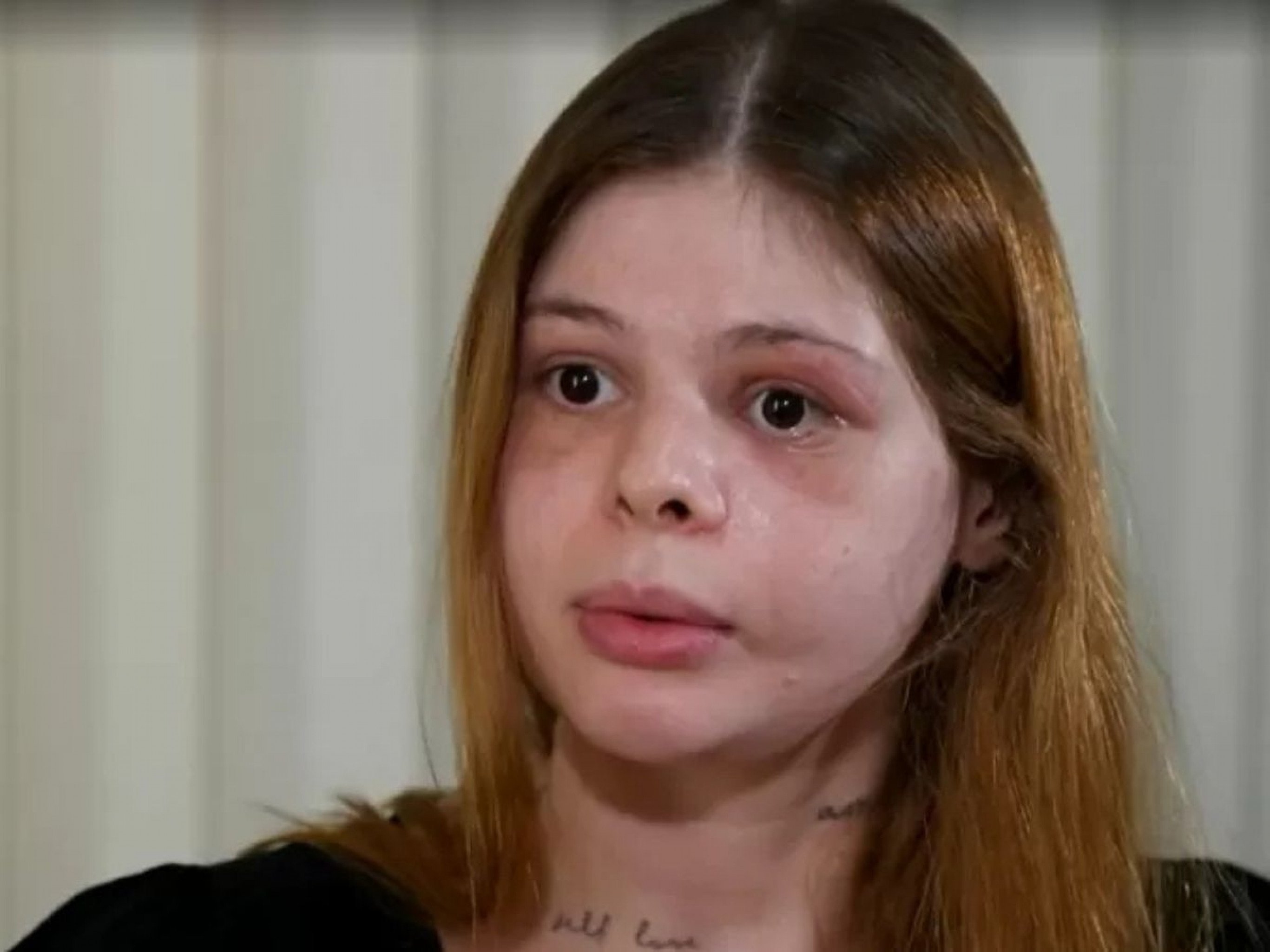 Médica conta ataque brutal de fisiculturista que durou 6 minutos e deixou ossos da face destruídos