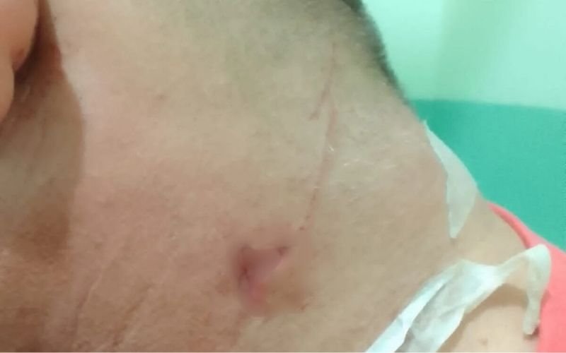 Justiça condena, mas manda soltar homem que estava preso por tentar matar motorista de app