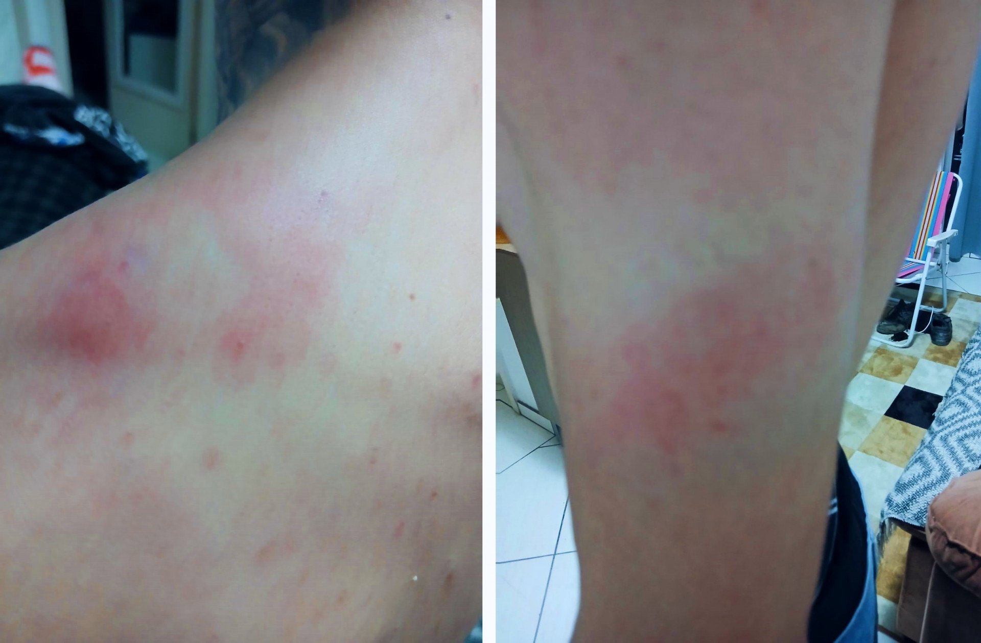 "Passaram com a moto por cima de mim e dispararam spray de pimenta", relata motociclista sobre abordagem da Guarda Municipal