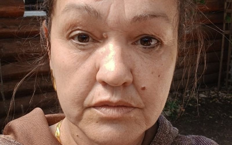 Deise Souza arrecada recursos para retirar pedras dos rins | abc+