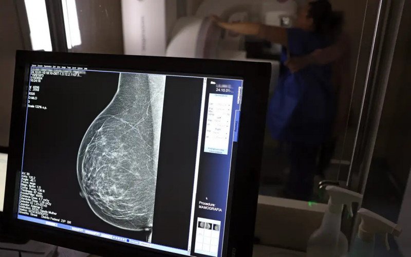 Ministério da Saúde passa a recomendar mamografia a partir dos 40 anos | abc+