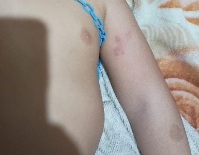 Professora é afastada após suposto caso de maus-tratos contra bebê de 1 ano e 10 meses