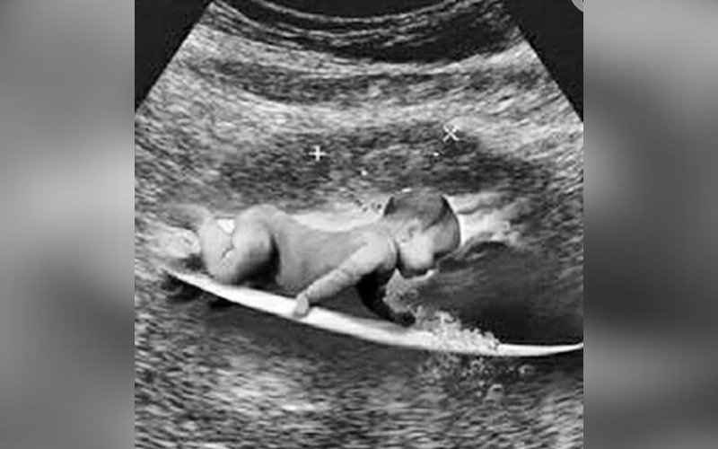Gabriel Medina postou foto do que parece um ultrassom | abc+