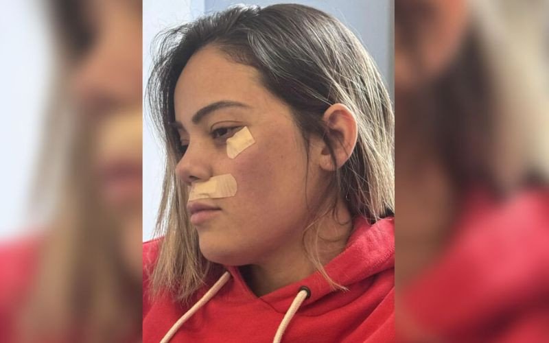 Empurrada e mordida: Brasileira sofre ataque e tentativa de estupro em trem na periferia de Paris | abc+