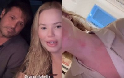 Advogada de Dado Dolabella se afasta de caso de violência contra Miss Gramado; entenda