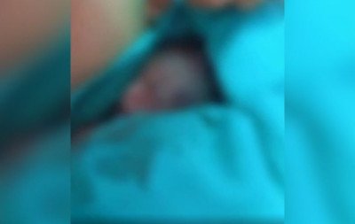 Bebê prematuro dado como morto e encontrado vivo em velório morre após um dia na UTI