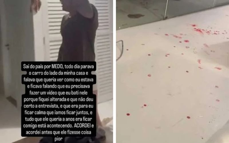Marcela compartilhou cenas de sangue no chão após briga com Dado Dolabella | abc+