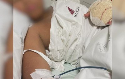 Caso de menino brasileiro que teve dedos decepados em escola de Portugal levanta dúvidas e consulado reage