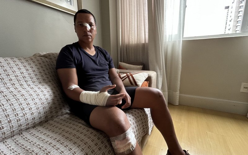 Professor de Direito, Fabrício Antônio da Silva, e as marcas que ficaram no corpo depois que foi atacado pelo vizinho, que invadiu sua casa armado com um facão | abc+