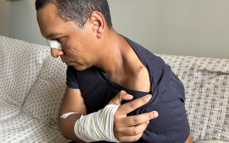 Professor de Direito, Fabrício Antônio da Silva, e as marcas que ficaram no corpo depois que foi atacado pelo vizinho, que invadiu sua casa armado com um facão | abc+