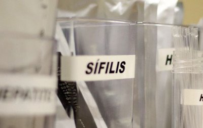 Sífilis continua em ritmo acelerado de crescimento no País; conheça os riscos e como prevenir