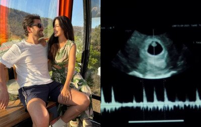 Remédios para emagrecer cortam o efeito do anticoncepcional? Entenda caso do bebê Mounjaro de casal de ex-BBBs