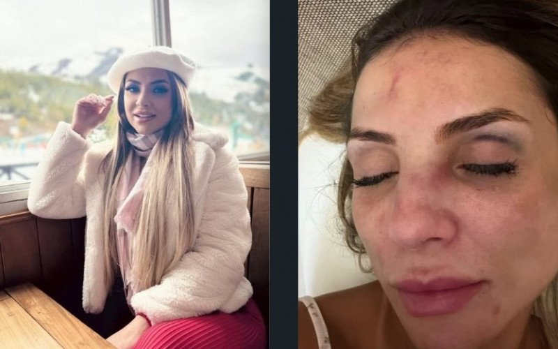 Rauana Botelho tornou público o caso de agressão sofrida pelo namorado abusivo | abc+