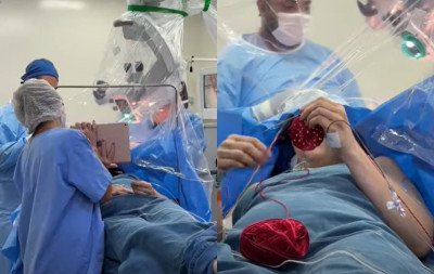 Paciente faz crochê enquanto passa por cirurgia em hospital no Brasil; veja vídeo