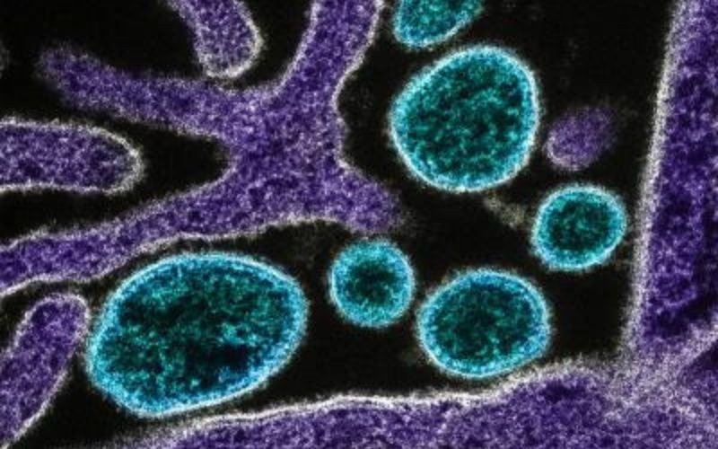 Vírus Nipah preocupa autoridades asiáticas | abc+