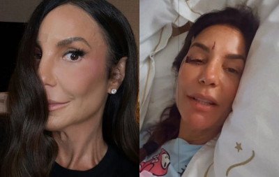 Ivete Sangalo recebe alta e tranquiliza fãs: "Já estou em casa"