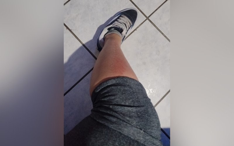 Vítima teve ferimentos na perna | abc+