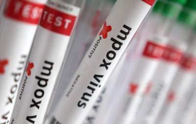 Sobe para 140 número de casos confirmados de Mpox no país, em 2026
