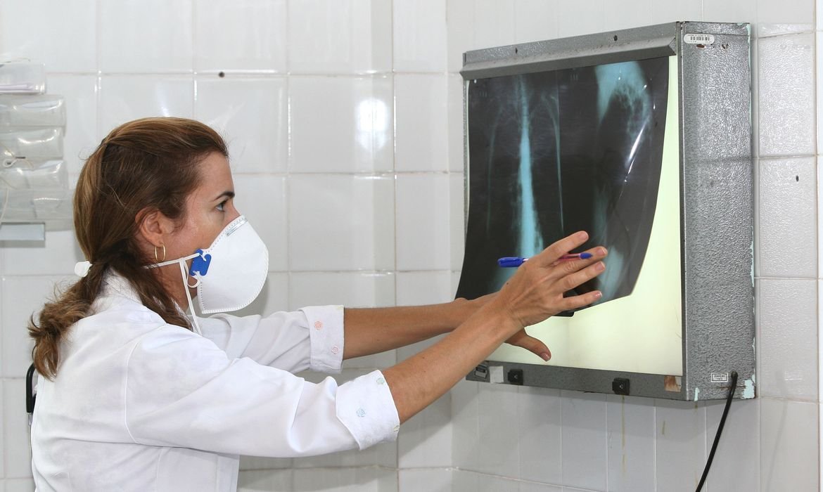 Testes de diagnóstico rápido para erradicar tuberculose são recomendados pela OMS