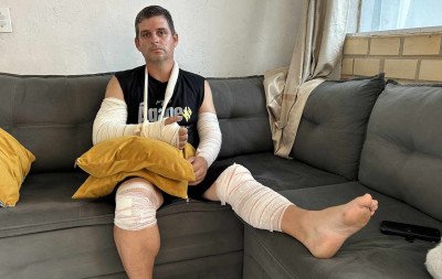 VÍDEO: "Não é simplesmente um cabo pendurado, são vidas que estão em risco", diz motociclista que se acidentou em fios soltos