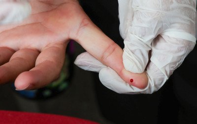 Teste rápido de dengue passa a ser oferecido no SUS