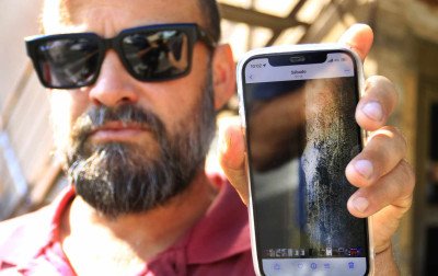 "Não merecia um destino assim", desabafa irmão de pedestre que ficou com bala alojada na cabeça após tiroteio entre policiais e fugitivos