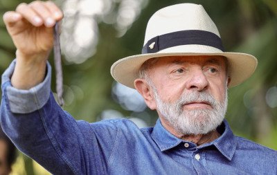 Lula passa por procedimentos para tirar excesso de pele na cabeça e tratar tendinite