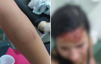 Socos, mordidas e puxões de cabelo: Crianças de 2 a 8 anos presenciam pai agredir mãe dentro de carro em frente a farmácia