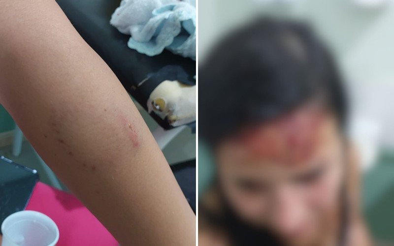 Mulher foi agredida pelo companheiro dentro do carro, em frente a uma farmácia no Centro de Estância Velha | abc+