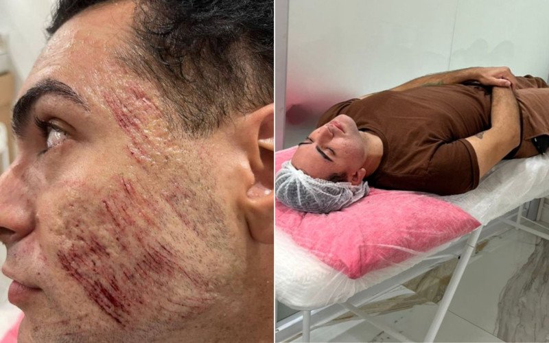 Henrique Chagas tinha 27 anos quando morreu após aplicação de peeling de fenol | abc+