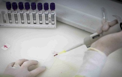 Visitante testa negativo para ebola; outro caso suspeito segue em investigação
