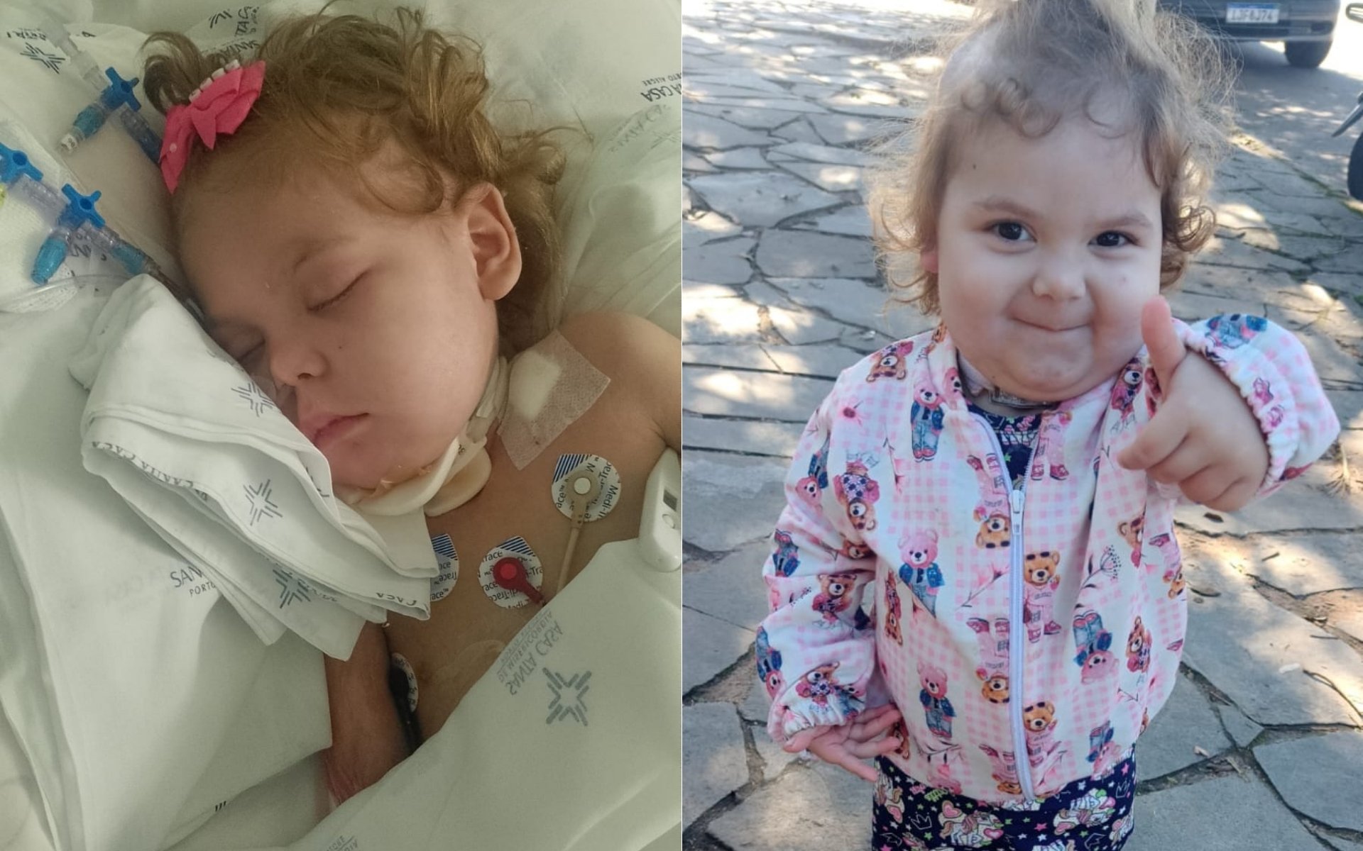 Menina de 4 anos enfrenta complica&ccedil;&otilde;es graves e fam&iacute;lia pede ajuda para continuar tratamento