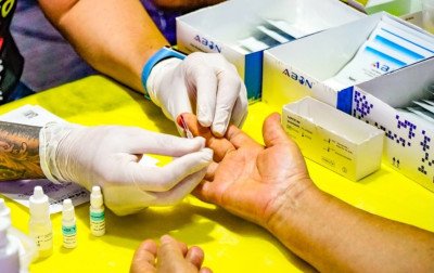 Canela terá testagem rápida para ISTs em turno estendido nesta semana; saiba mais