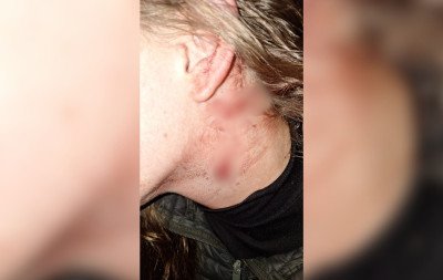 Jovem grávida é agredida com garrafada pelo namorado no Vale do Sinos