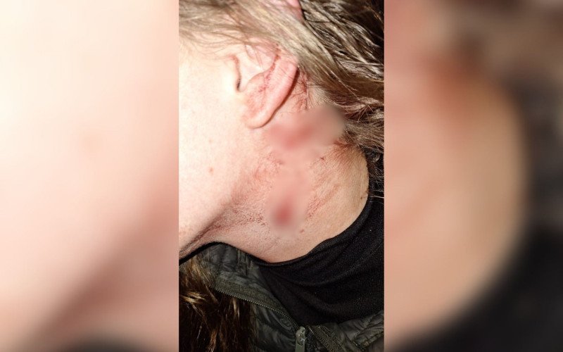 Jovem foi agredida do próprio namorado em Estância Velha | abc+