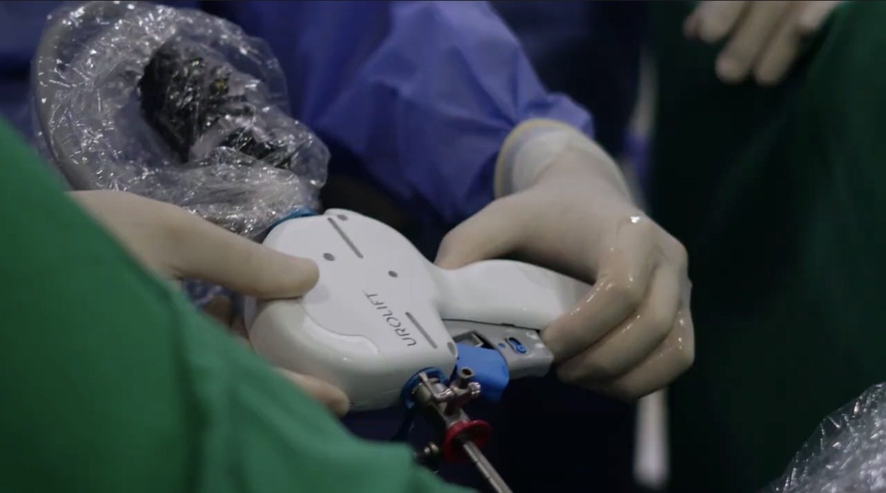 UroLift: nova opção minimamente invasiva para tratar o HPB