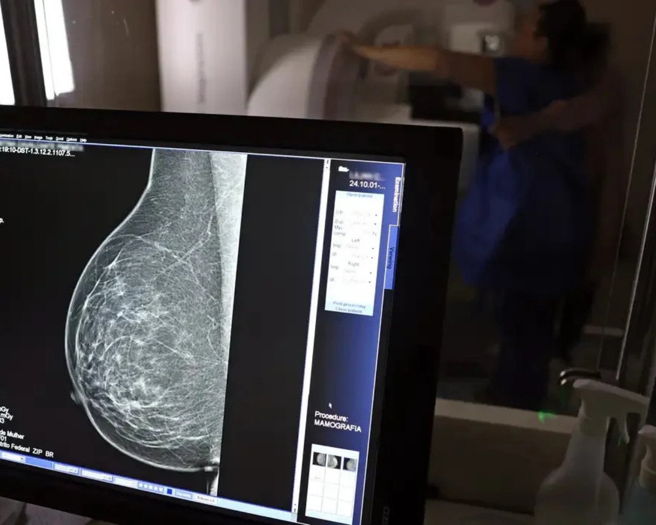 Agendamentos para mamografias serão retomados nesta terça-feira em São Leopoldo