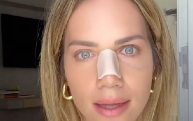 Giovanna Ewbank passa por recuperação complicada após cirurgia  | Jornal NH