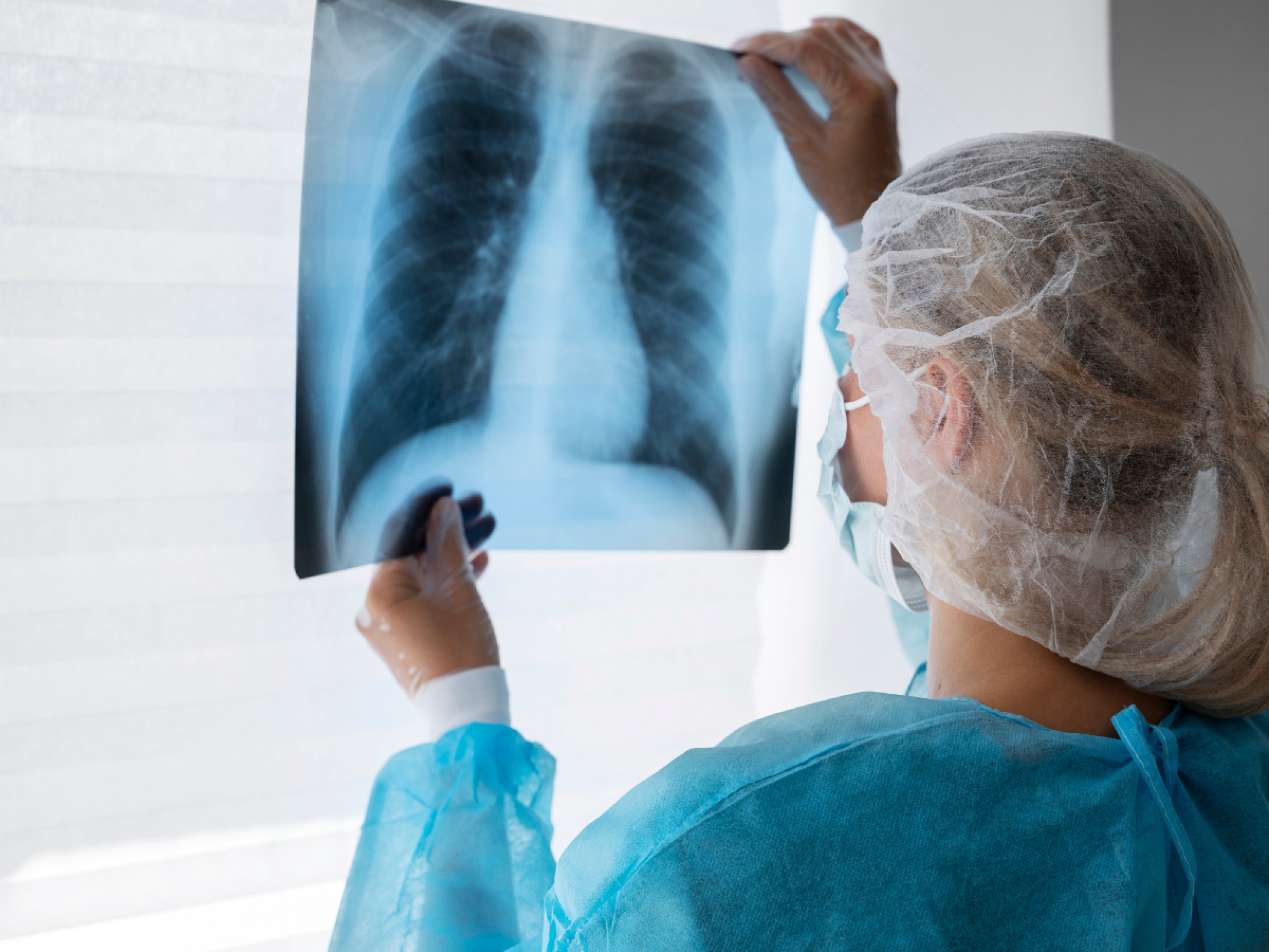Quais são os primeiros sinais do câncer de pulmão? Saiba mais sobre a doença da atriz Jandira Martini